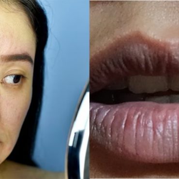 bibir hitam