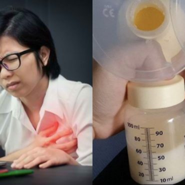 cara atasi bengkak susu
